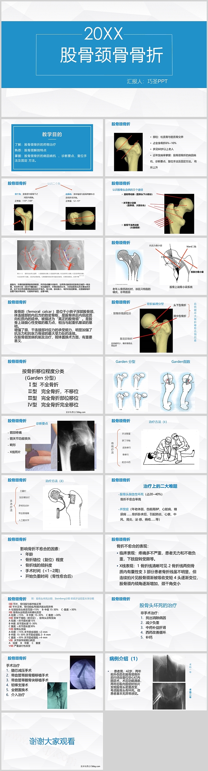 蓝色精美股骨颈骨骨折护理查房PPT模板