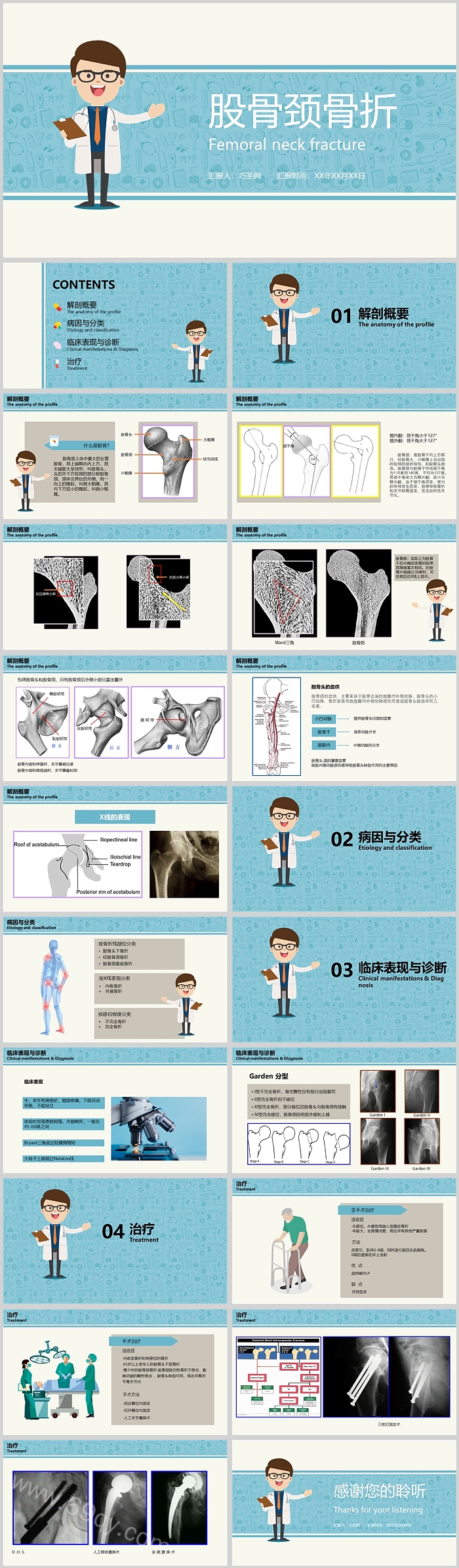 极简风格股骨颈骨折护理查房PPT模板