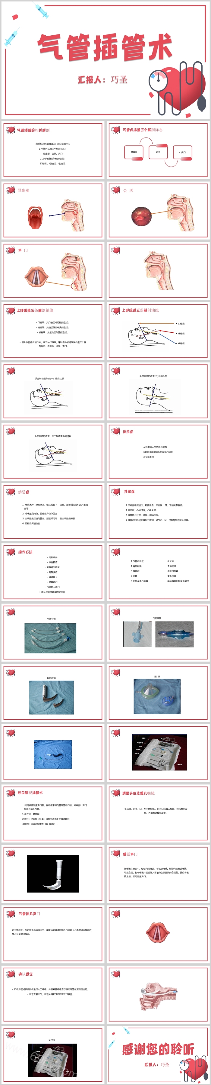 红色精美气管插管术后护理查房PPT课件