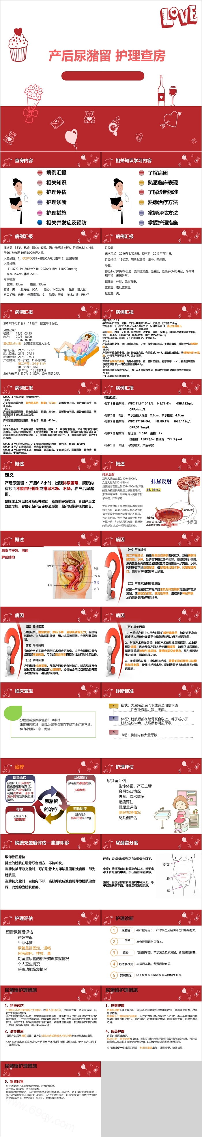 产后尿潴留护理查房护理诊断PPT模板