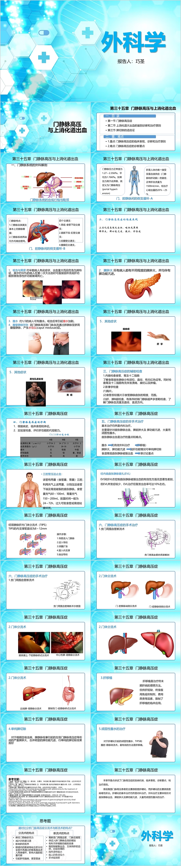 外科学门静脉高压与上消化道出血PPT模板