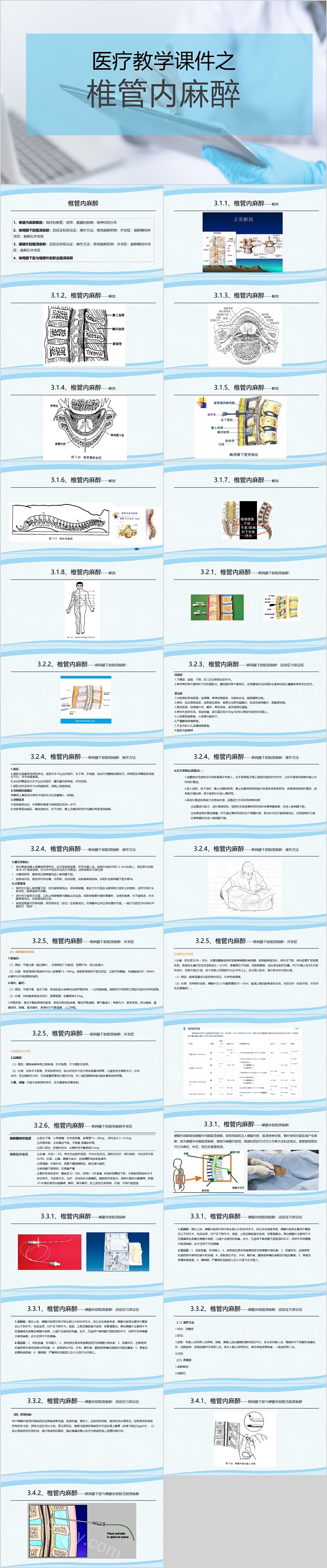 医疗教学课件之椎管内麻醉PPT模板