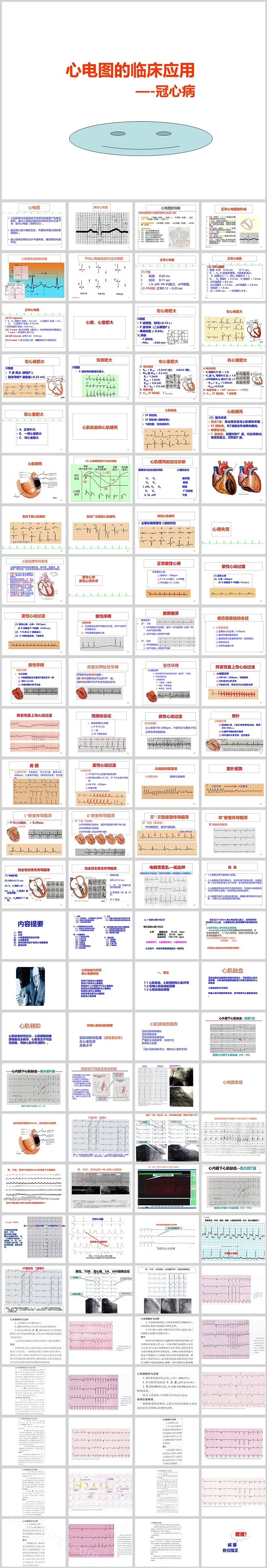 简约风医疗医学冠心病心电图的临床应用PPT模板