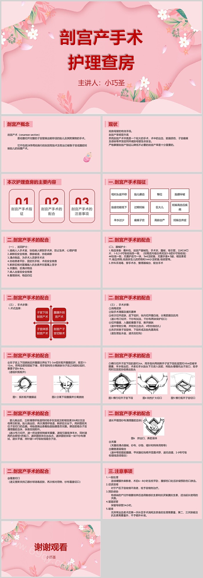 医院手术室剖宫产手术护理查房ppt课件