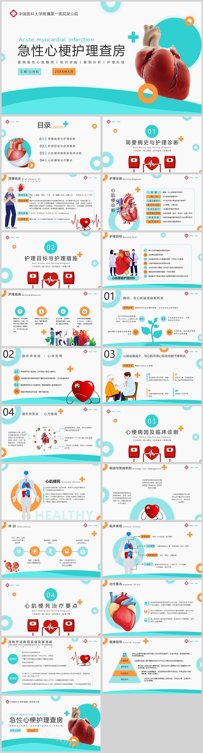 优质完整版全套急性心梗教学护理查房ppt课件