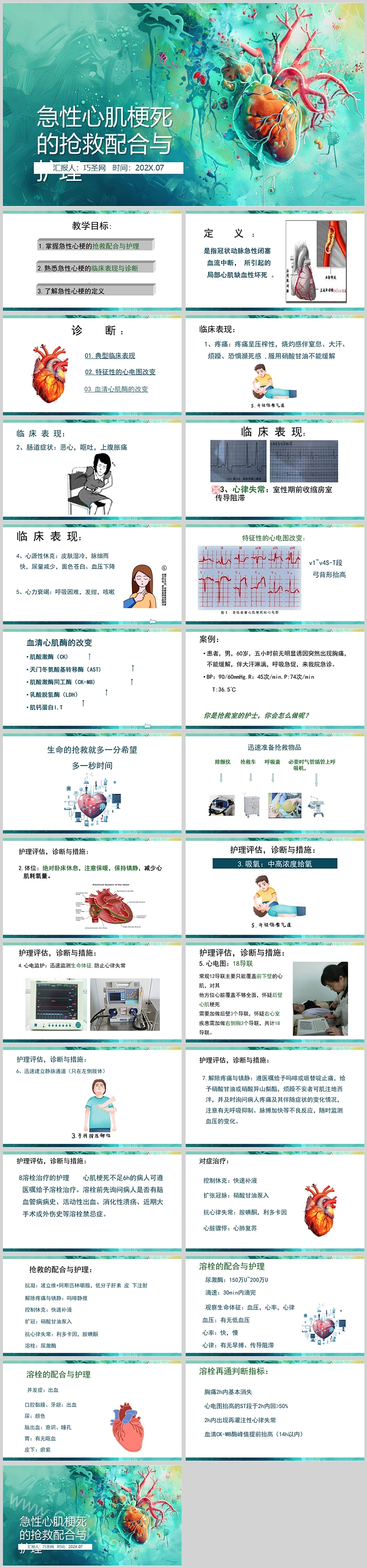 完整版医院急性心肌梗死的抢救配合与护理教学查房ppt课件