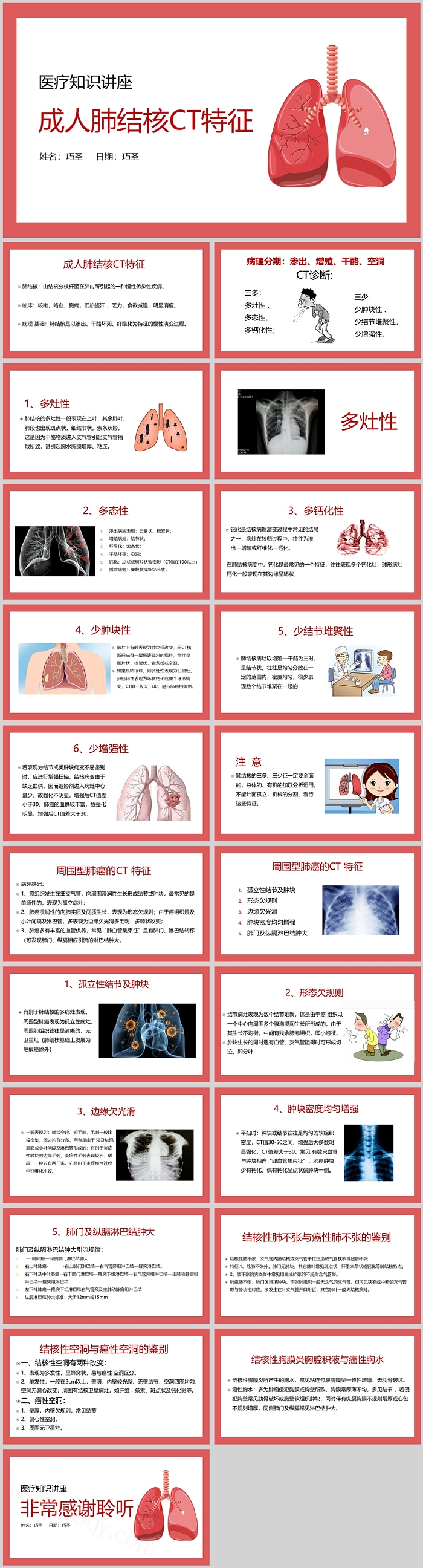 成人肺结核CT特征医学医疗诊断与表现知识讲座PPT课件